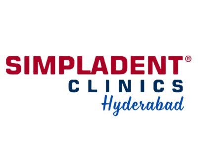 Best Dental Implant Clinic in Hyderabad