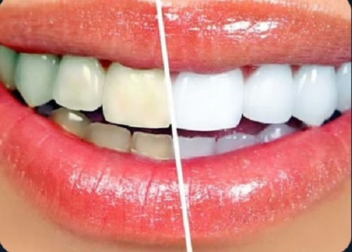 Tattva Dental Care - Best Dental Clinic in Padmanabhanagar,Banashankari