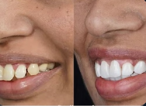 Tattva Dental Care - Best Dental Clinic in Padmanabhanagar,Banashankari
