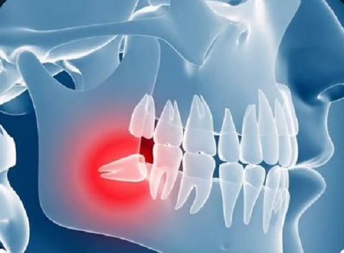 Tattva Dental Care - Best Dental Clinic in Padmanabhanagar,Banashankari