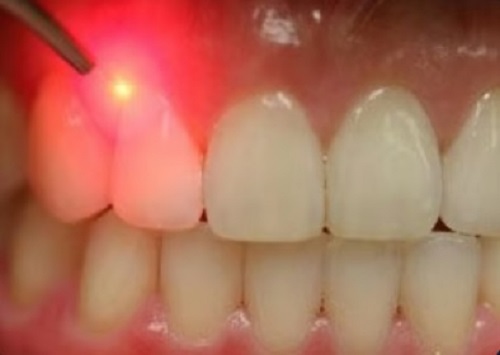 Tattva Dental Care - Best Dental Clinic in Padmanabhanagar,Banashankari