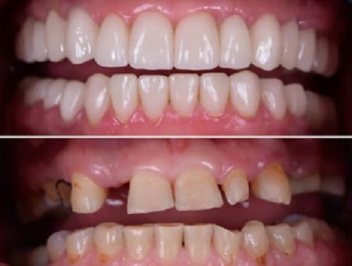 Tattva Dental Care - Best Dental Clinic in Padmanabhanagar,Banashankari