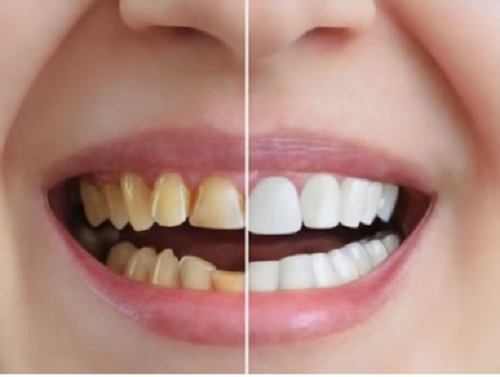 Tattva Dental Care - Best Dental Clinic in Padmanabhanagar,Banashankari