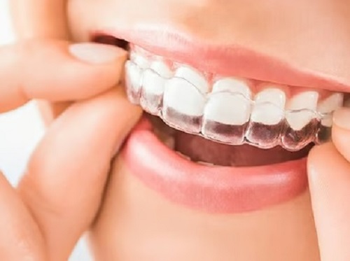 Tattva Dental Care - Best Dental Clinic in Padmanabhanagar,Banashankari