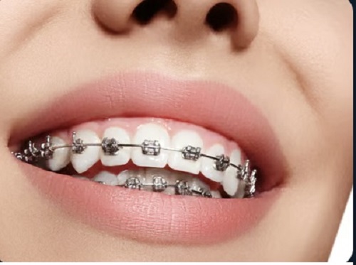 Tattva Dental Care - Best Dental Clinic in Padmanabhanagar,Banashankari