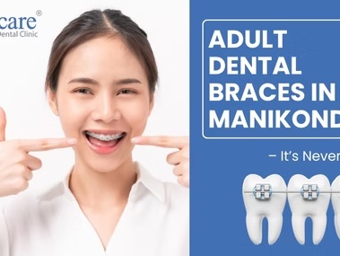 Bracecare Dental - Best Dental Clinic in Manikonda | Invisalign & Braces Hyderabad