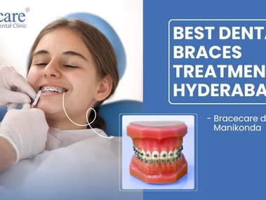 Bracecare Dental - Best Dental Clinic in Manikonda | Invisalign & Braces Hyderabad
