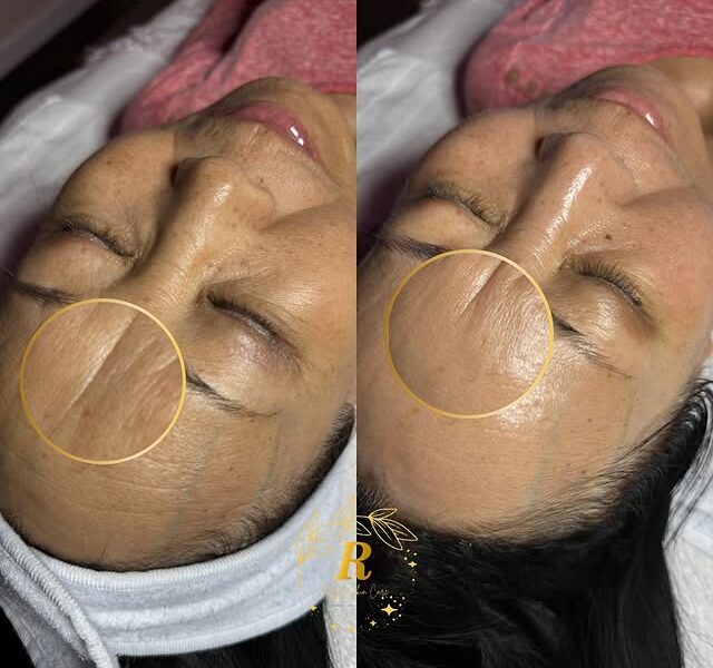 Royal Skin Care