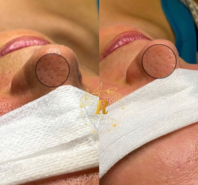 Royal Skin Care