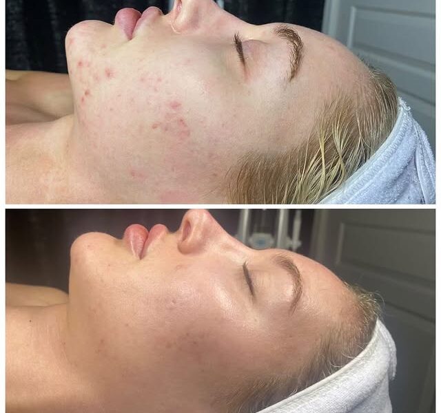 Royal Skin Care